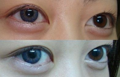 OFERTA Lentillas a 3€