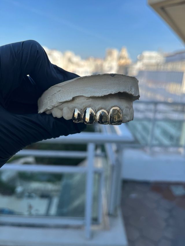 Grillz de elaboracion artesanal en toda españa