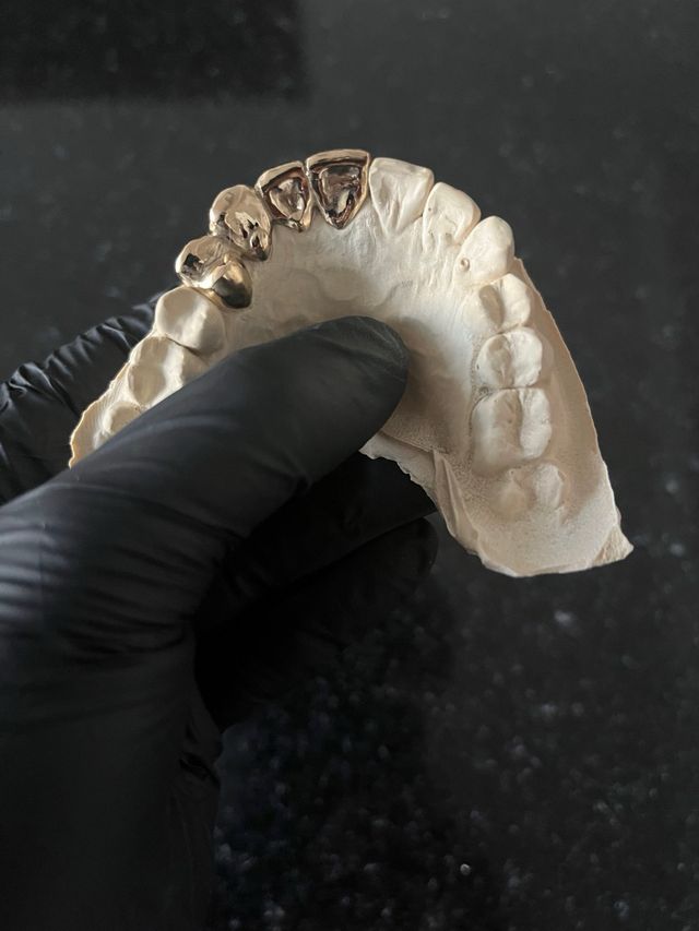 Grillz de elaboracion artesanal en toda españa