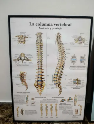 Cuadro Anatomía Columna Vertebral
