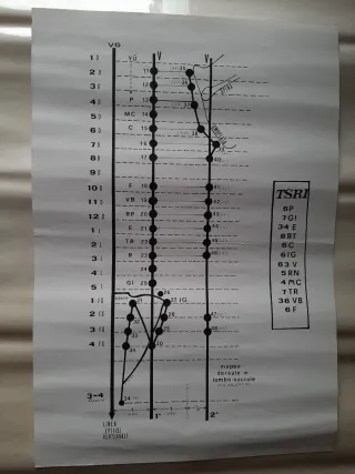 Coppia di tavole vintage con punti di agopuntura