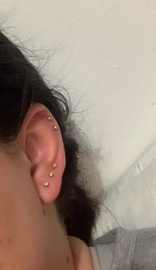 PERFORACIONES DE BEBÉS