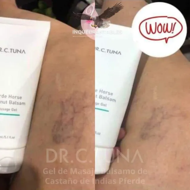 Gel Masaje Dr. C. Tuna Pferde Horse Chestnut