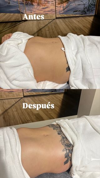 Promoción de Maderoterapia para mujeres