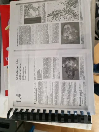 Parziale di patologia della gravidanza