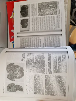 Parziale di patologia della gravidanza