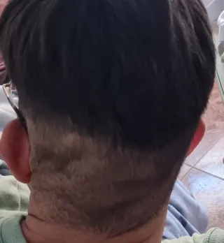 Prótesis capilar hombre