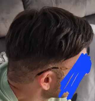 Prótesis capilar hombre