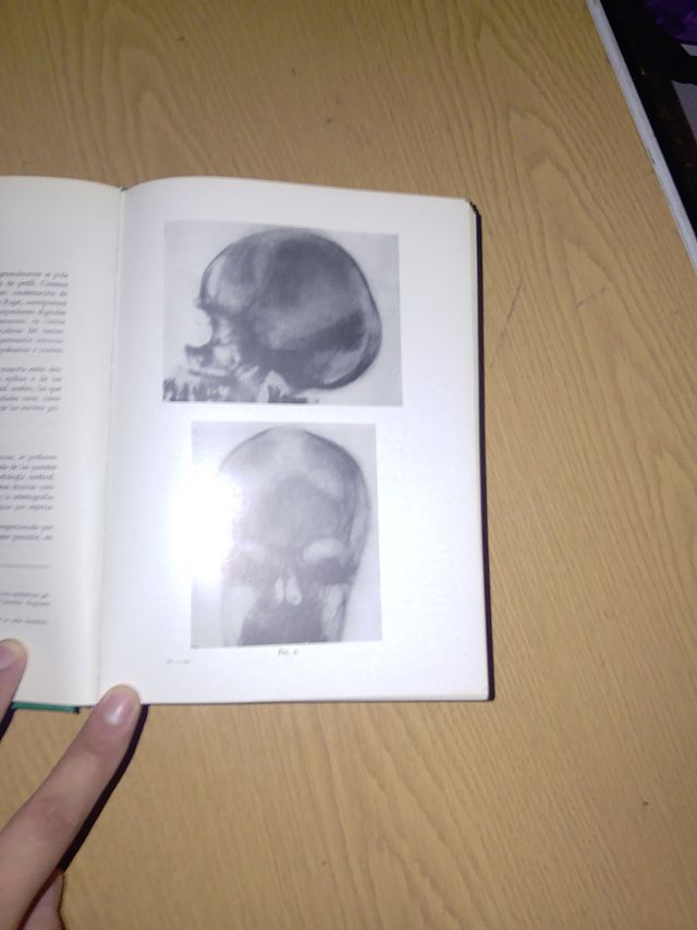 Tratado de Psiquiatría