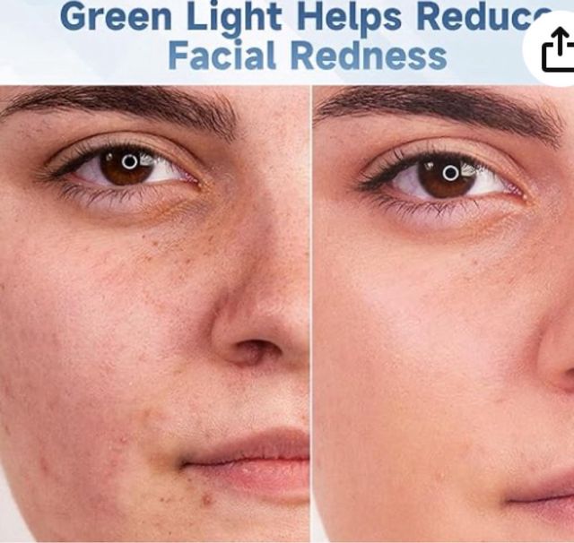 Mascarilla LED Facial 7 Colores