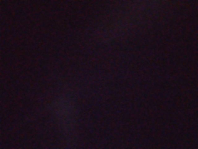 Máquina TDES Solilaser Electroporación