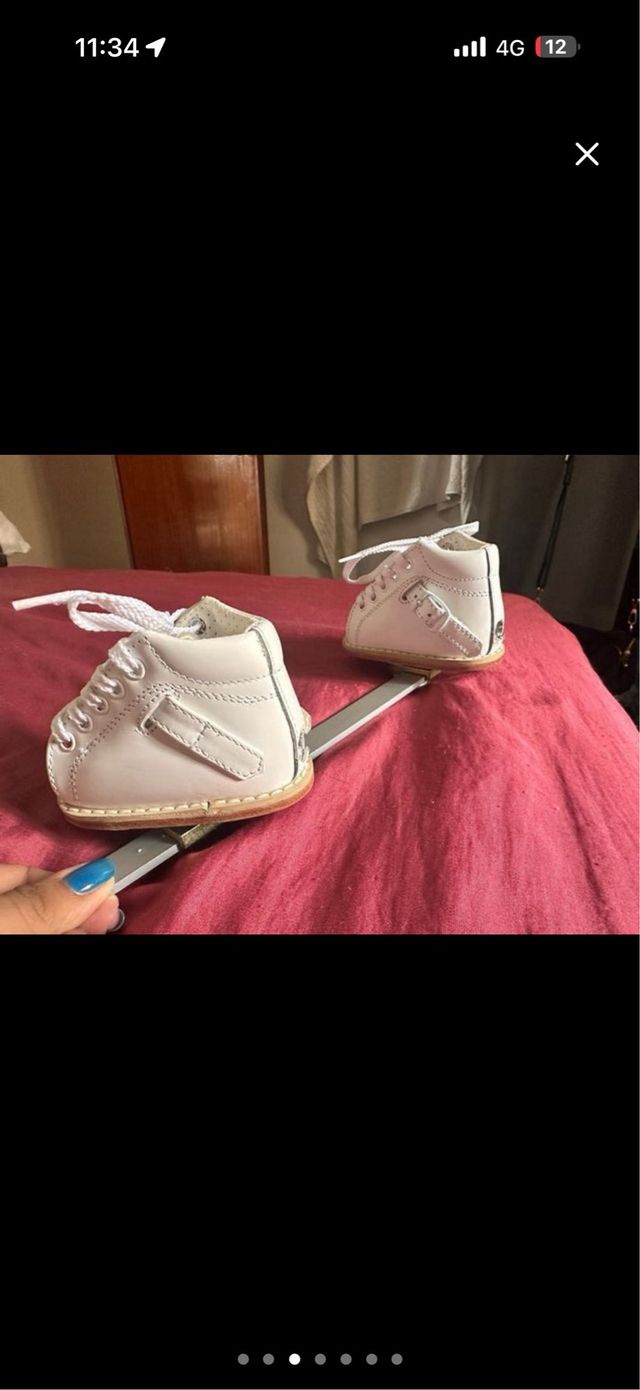 Botas ortopédicas Ponseti blancas