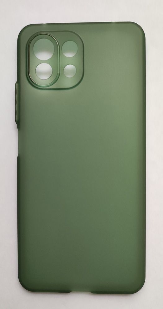 Funda Xiaomi Mi 11 Lite 4G/5G/5G NE