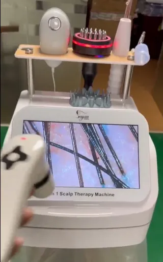 Microcamara piel, Diagnóstico y cuidado capilar y