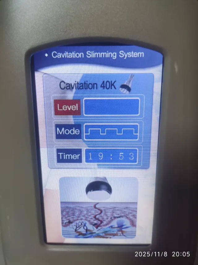 Máquina Cavitación y Radiofrecuencia RF