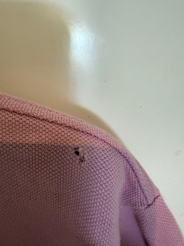 tiene agujerito en el hombro muestro foto