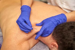 Fisioterapia a Domicilio