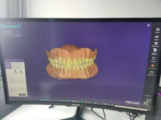 Mini PC para Software Dental (Exocad)