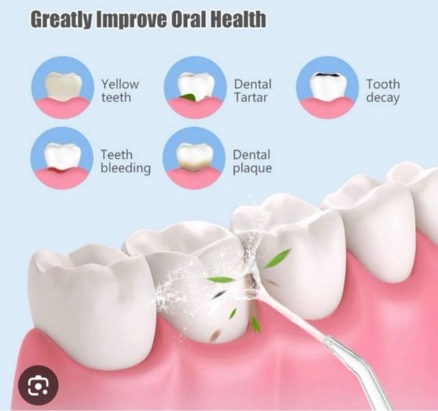 Irrigador Bucal Dental Portátil