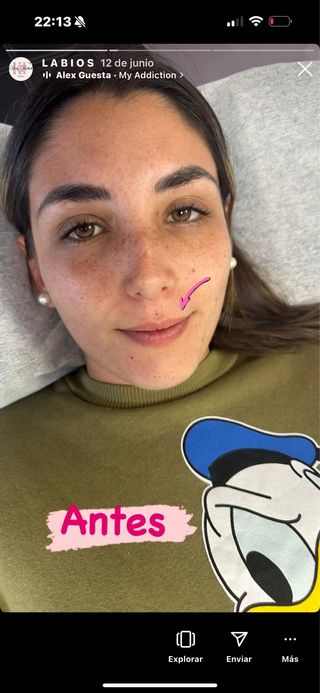 CURSO DE MICROPIGMENTACION