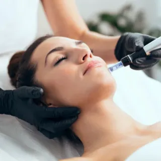 Tratamiento de dermapen facial a domicilio