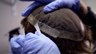 Mantenimiento prótesis capilar a domicilio Madrid