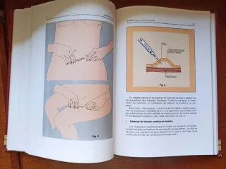 Las Diabetes Mellitus