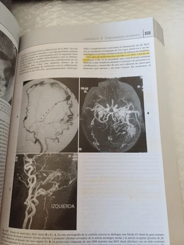 NEURORRADIÓLOGA de residente