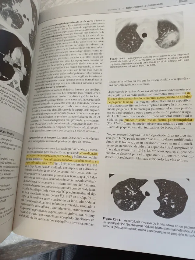 RADIOLOGIA PULMONAR y CARDIOVASCULAR flexilibro...