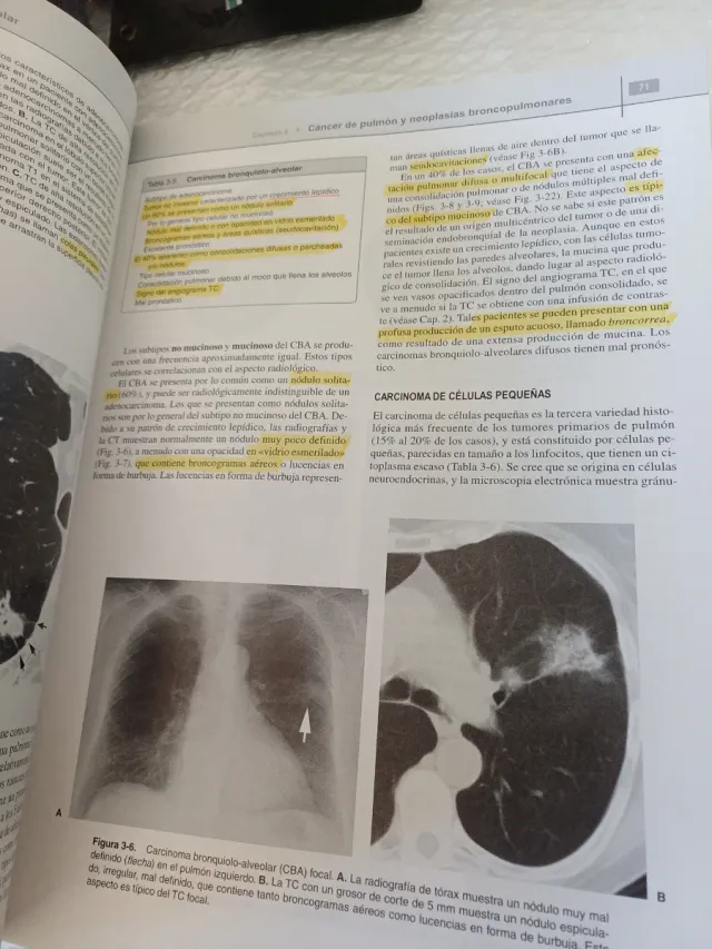 RADIOLOGIA PULMONAR y CARDIOVASCULAR flexilibro...
