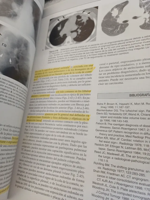 RADIOLOGIA PULMONAR y CARDIOVASCULAR flexilibro...