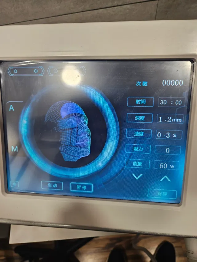 Radiofrecuencia Fraccionada con 10 cabezales