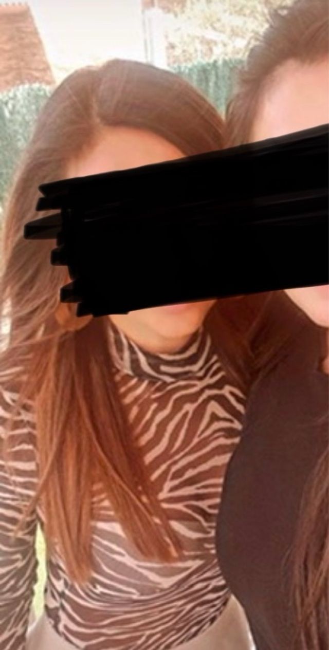 Body Bershka estampado cebra Talla XS/S