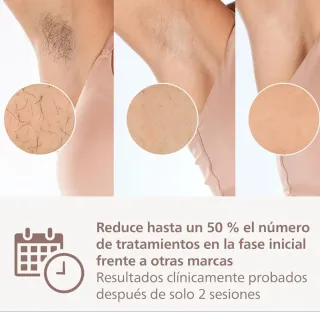 Depiladora IPL Láser