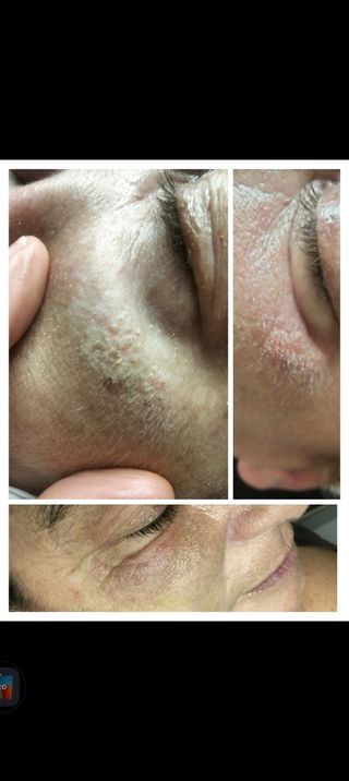 Tratamientos de estética