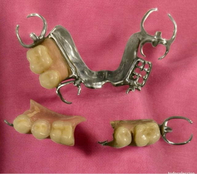 Antigua prótesis dental metálica