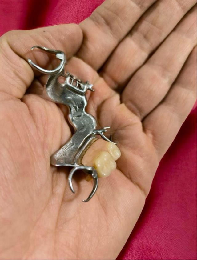 Antigua prótesis dental metálica