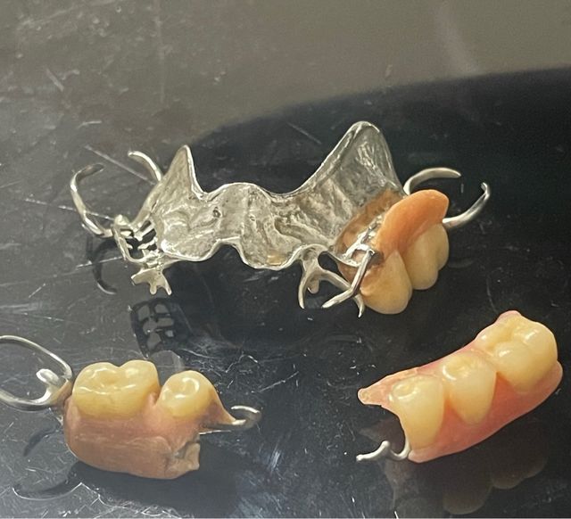 Antigua prótesis dental metálica