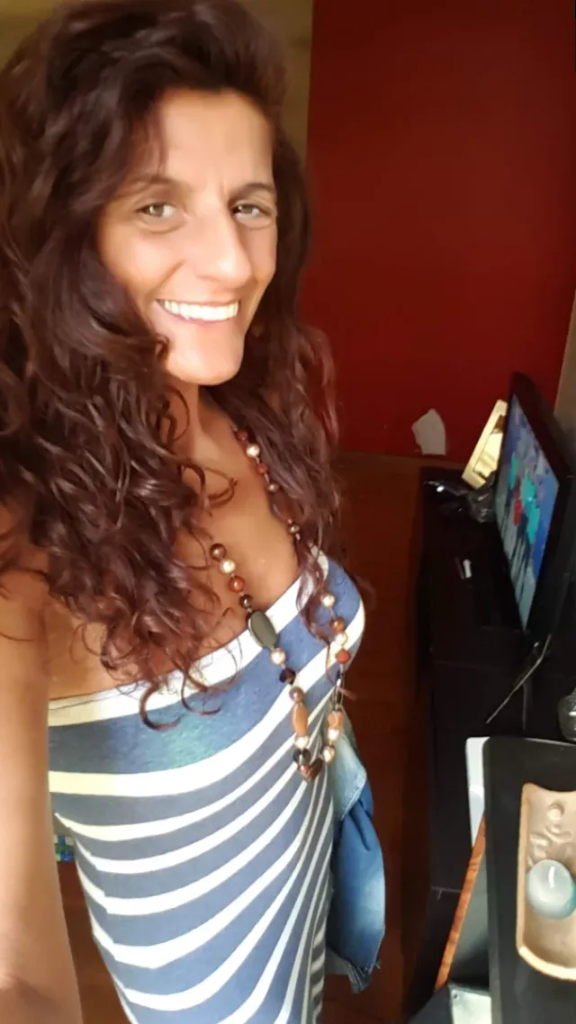 Vestido de rayas de algodón