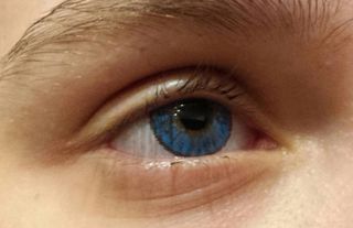 Lentillas OFERTA 3€