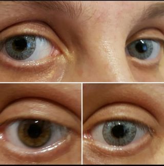 Lentillas OFERTA 3€