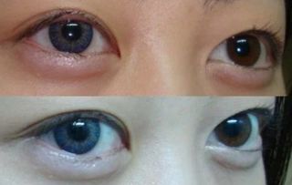 Lentillas OFERTA 3€