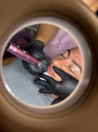 ✨ LIMPIEZA FACIAL PROFUNDA + HIDROFACIAL DERMAPEN