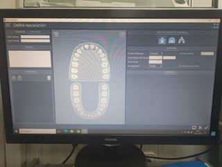Escáner 3D Kulzer + PC + Impresora