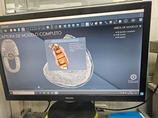 Escáner 3D Kulzer + PC + Impresora