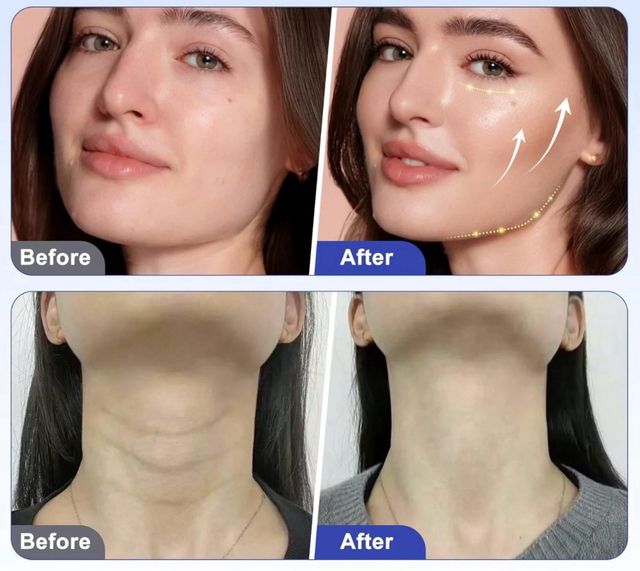 Massaggiatore 4 in 1 Anticellulite Tonificante New