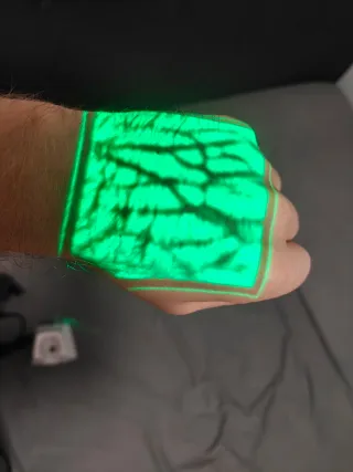 Detector profesional de venas AccuVein AV500