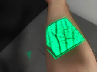 Detector profesional de venas AccuVein AV500