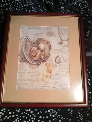 Representación feto vintage