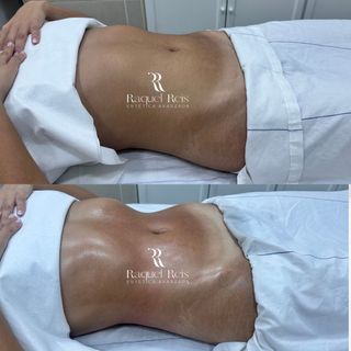 TRATAMIENTO Y BIENESTAR A DOMICILIO